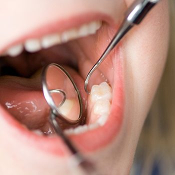 Factors that can affect the cost of pulp therapy include the location of the infected tooth