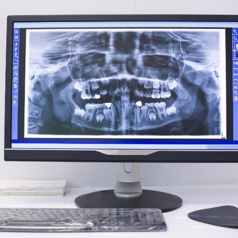 Digital x-rays displayed on computer screen
