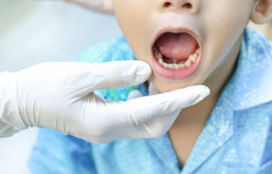 Dentist examining a child’s mouth for lip and tongue ties
