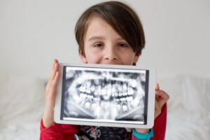 Kid showing X-ray of his teeth. 
