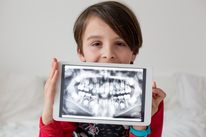 Kid showing X-ray of his teeth.